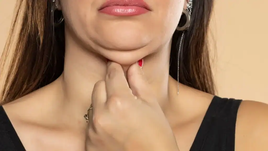 An image of a woman with double chin, sad, worried : Non Surgical Double Chin Removal Treatment in Hertfordshire, UK